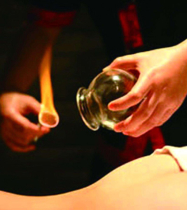 cupping therapie, chinese cupping, cupping, cupping method, wat is cupping