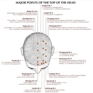 head points